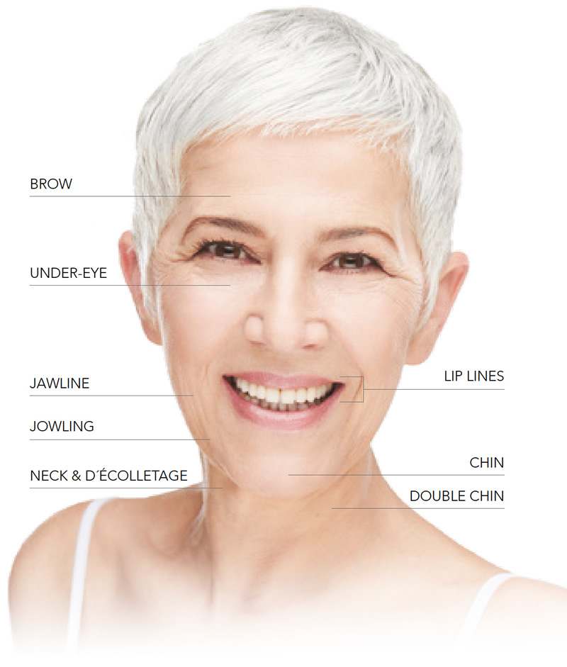 Endodefine can be used to treat the following areas