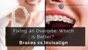 Fixing an Overbite: Which is Better? Braces vs Invisalign - Harrow ...