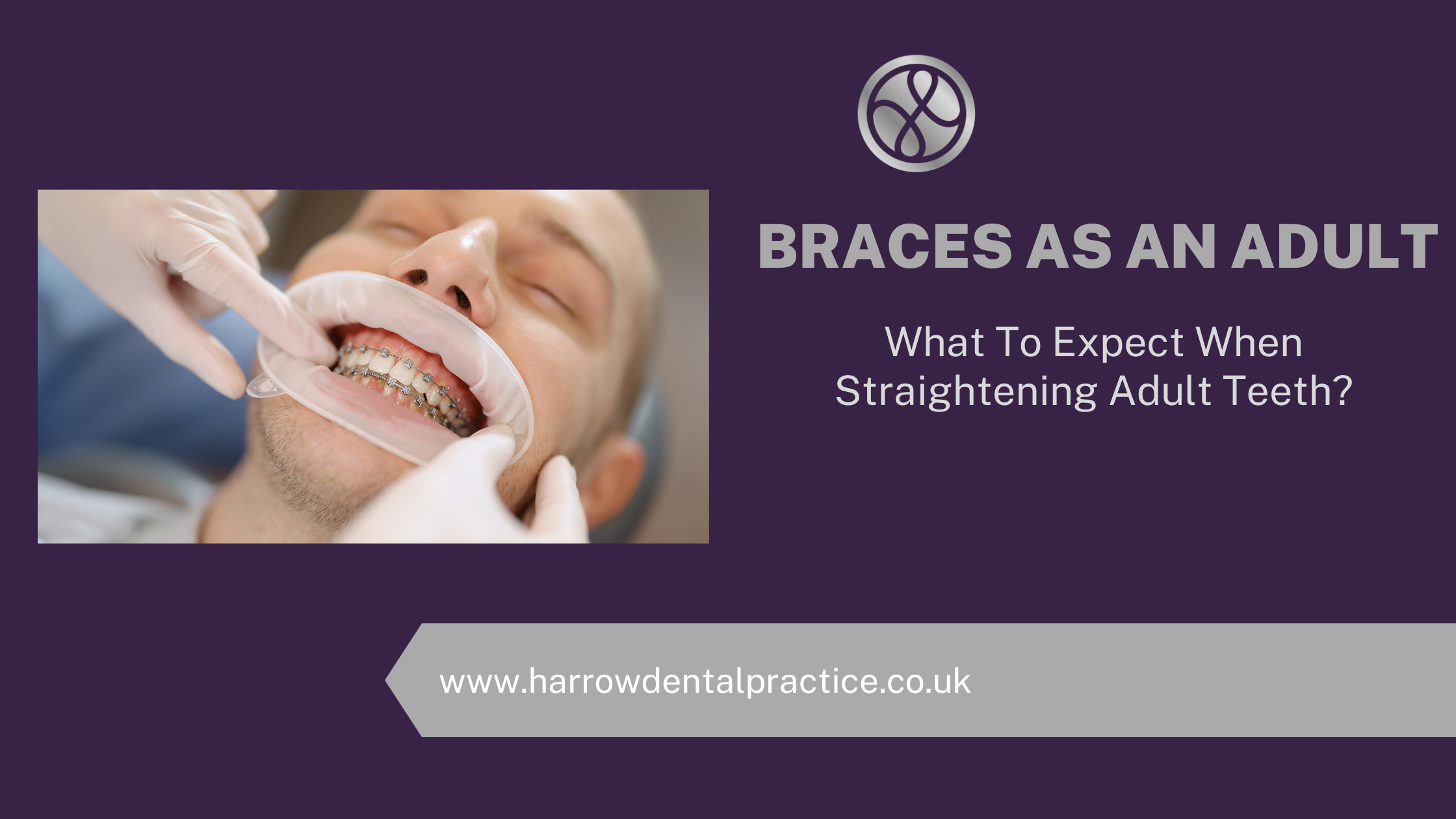 Braces As An Adult What To Expect When Straightening Adult Teeth Harrow Dental Practice Blog