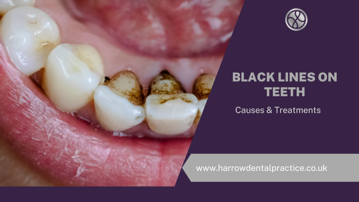 Black Lines On Teeth: Causes & Treatments