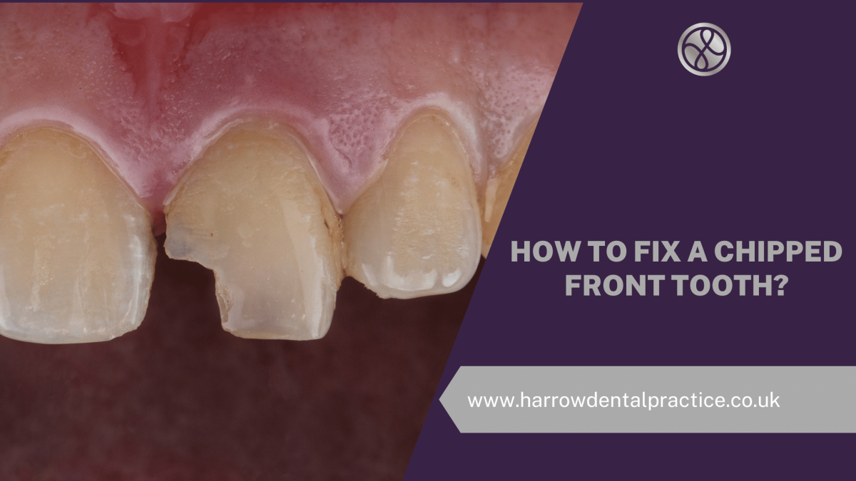 How To Fix A Chipped Front Tooth?